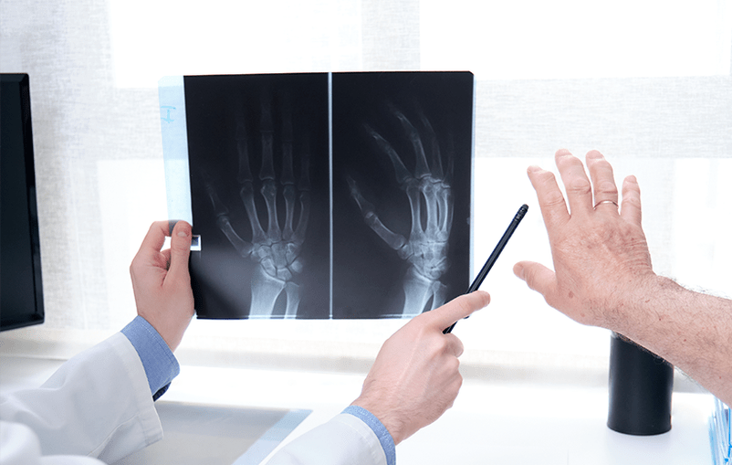 diagnosis of joint osteoarthritis