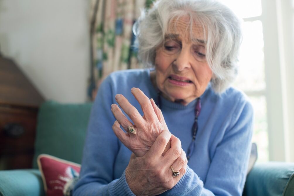 osteoarthritis of the joints of the hands in an elderly woman